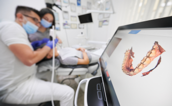  The trouble of measuring with a 3D scanner in dentistry is over!